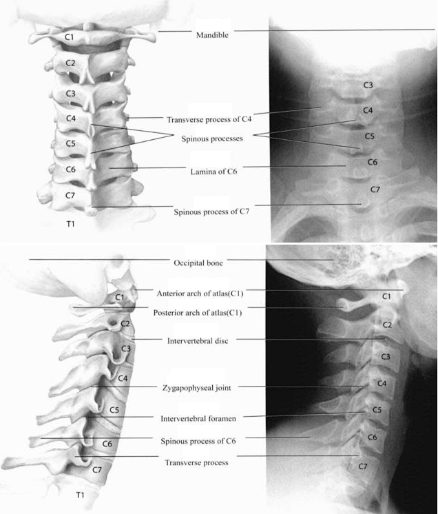 Cervical bones