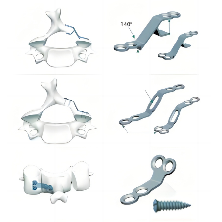 cervical vertebral plates