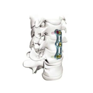 Anterior Cervical Plate System