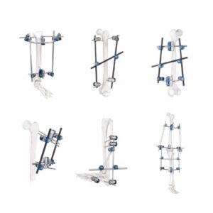 Lower Limb Combinational External Fixation System
