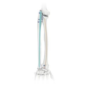 Radius & Unla Nails